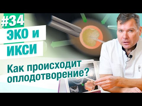 Икси - Кости видео (клип)