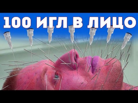 Лица - Иголки видео (клип)